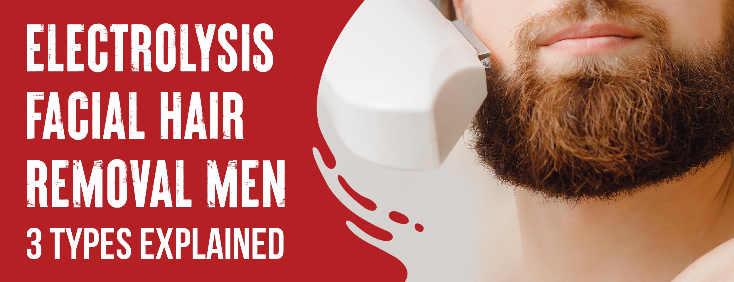 Using electrolysis for the removal of facial hair in men
