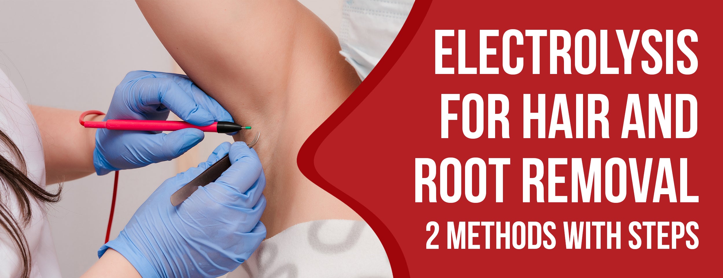 4 Steps and Benefits of Electrolysis for Hair and Root Removal