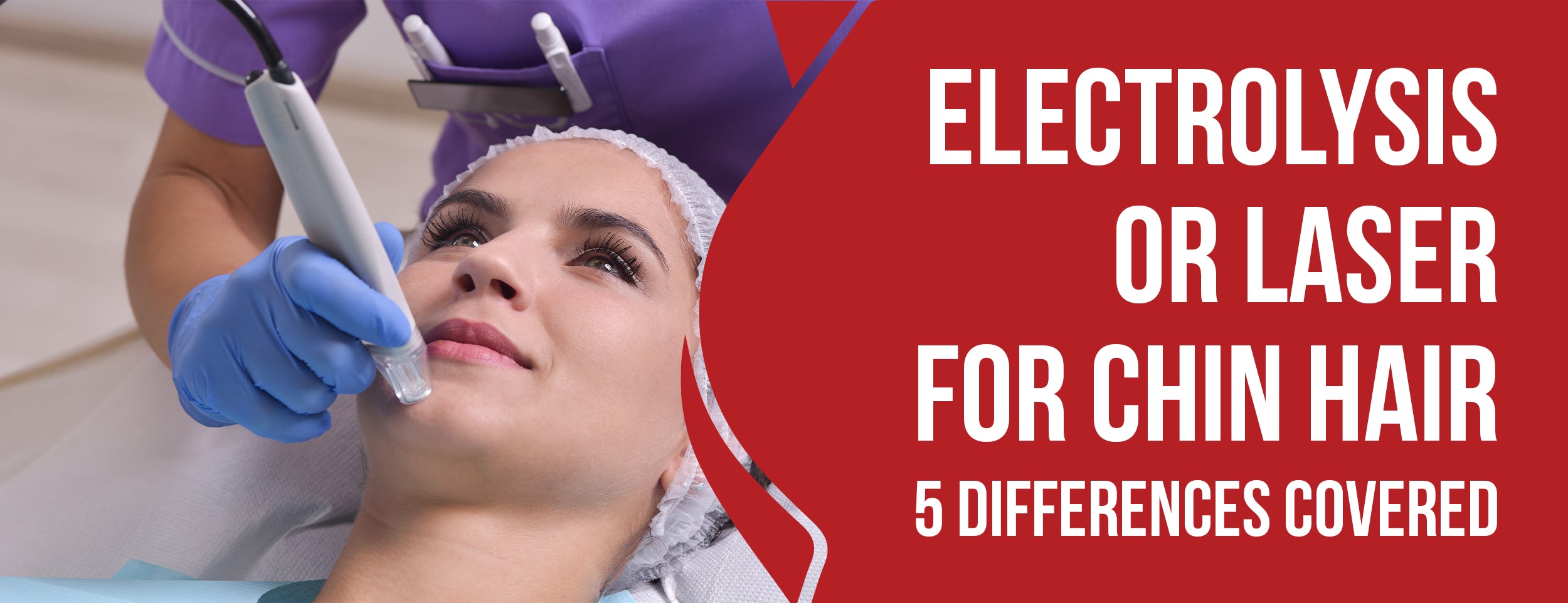 Facts About Electrolysis vs Laser for Chin Hair