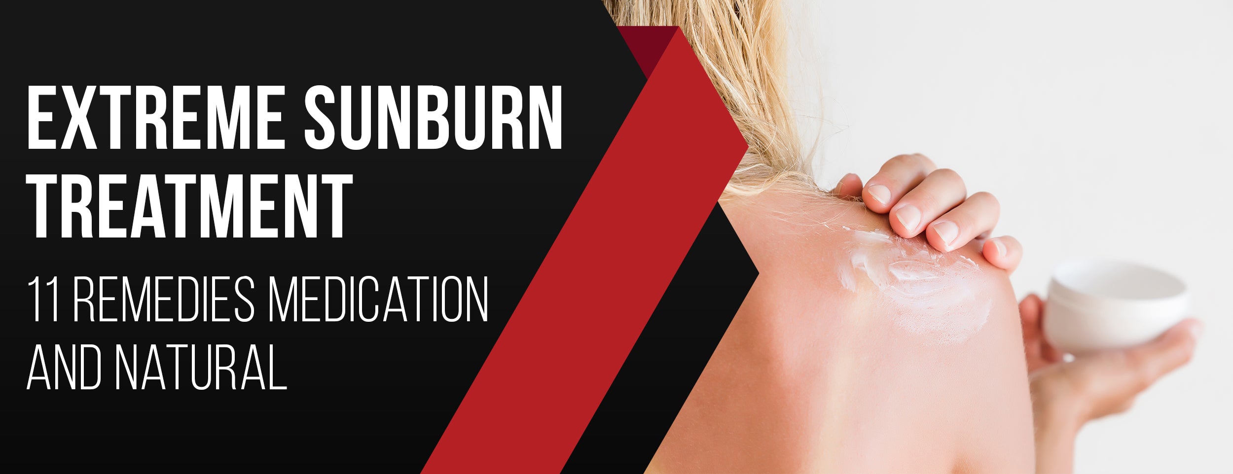 Extreme Sunburn Treatment: 11 Remedies [Medication & Natural] – Dr. Numb®
