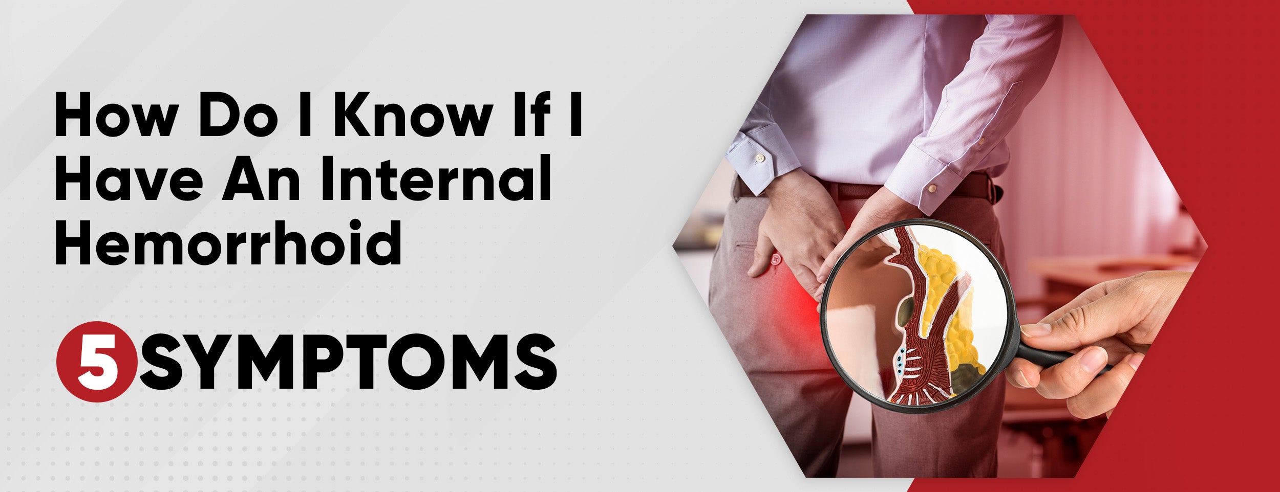 One of the most common types of hemorrhoids is an internal hemorrhoid