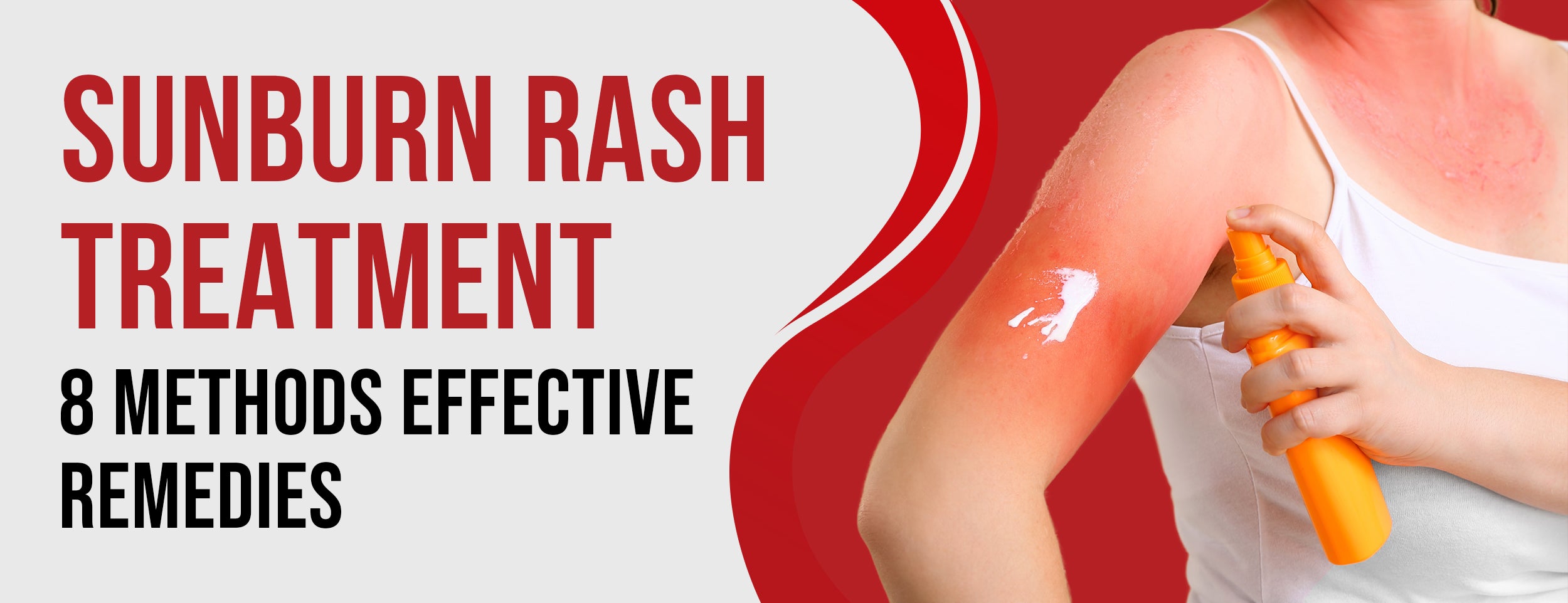 Medical Procedures and Home Remedies for Sunburn Rash