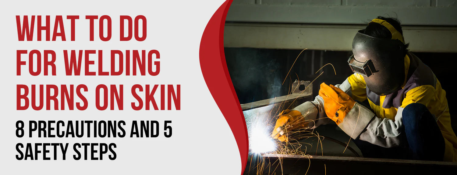 The 8 Precautions & 5 Initial Steps to Treat Welding Burns On Skin