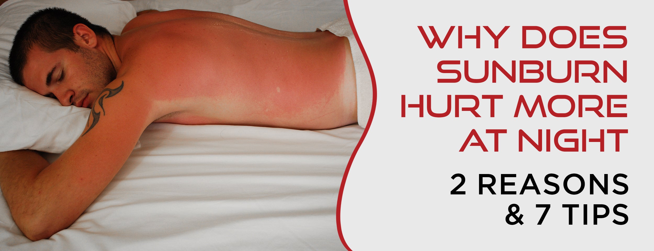 2 Reasons & 7 Tips Why Sunburn Hurts More at Night